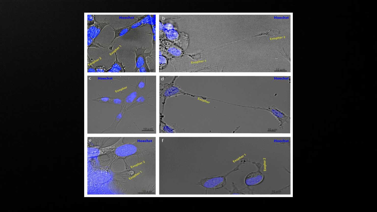 <p>Exophers appear to mediate neuronal communication. SH-SY5Y cells were stained with Hoechst and imaged using brightfield and fluorescence microscopy. a, b) Examples of exophers emanating from another exopher (N = 4 observations). c, d) Examples of exophers connected to two or more different cells via nanotubes (N = 6). e, f) Examples of exophers originating in two adjacent cells in contact with each other (N = 3).</p>
