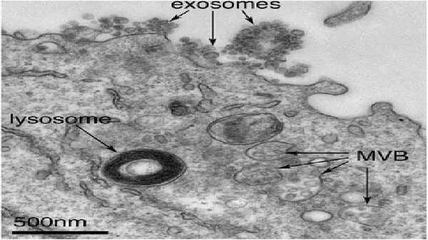 <p>Exosomes correspond to intraluminal vesicles of multivesicular bodies. A transmission electron micrograph of an Epstein–Barr virus-transformed B cell displaying newly expelled exosomes at the plasma membrane. Multivesicular bodies (MVB) can be seen which can deliver content to lysosomes for degradation or can fuse with the cell surface to release intraluminal vesicles as exosomes, indicated by the arrows at the top of the picture</p>